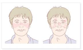 2025年1-12月干細胞治療系統性紅斑狼瘡匯總：多項臨床試驗全面提速！