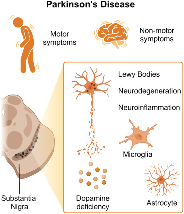 圖1：帕金森病的臨床和神經(jīng)病理學(xué)特征
