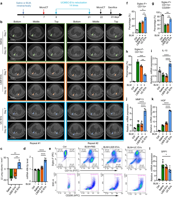 圖3：EVs在肺纖維化治療中的作用。