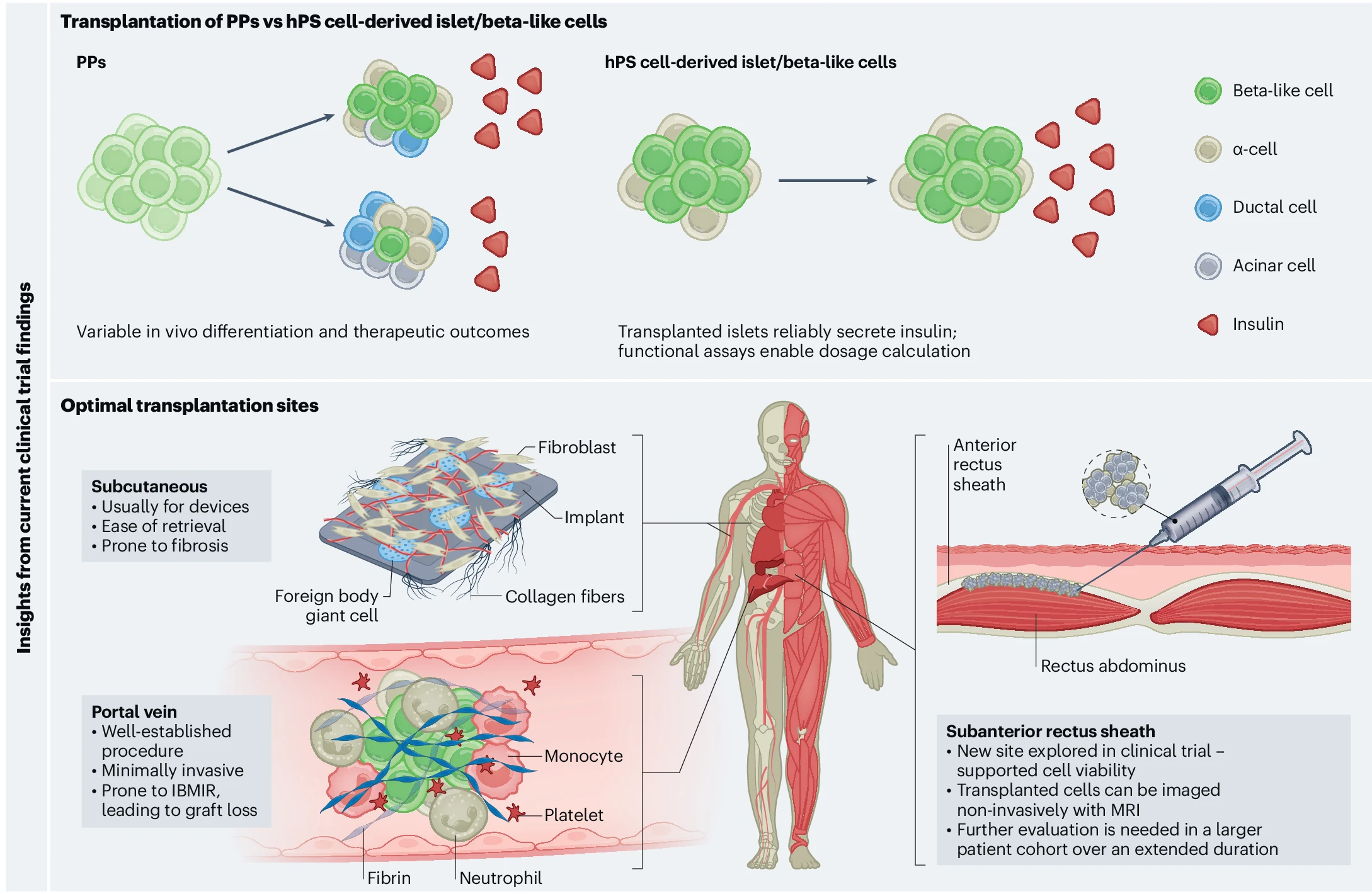圖2：最新干細胞治療糖尿病的創(chuàng  )新和經(jīng)驗教訓