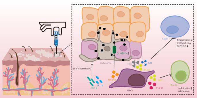 圖1：白癜風(fēng)患者皮膚注射MSCs后對局部皮膚的潛在免疫調節和抗炎作用