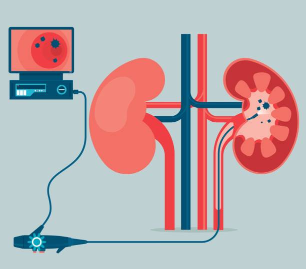2025糖尿病腎病的5種最新治療方法指南（截至10月）