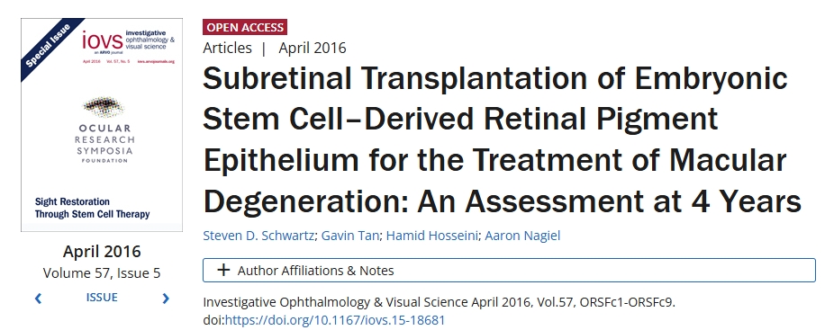 胚胎干細胞來(lái)源的視網(wǎng)膜色素上皮視網(wǎng)膜下移植治療黃斑變性：4年評估