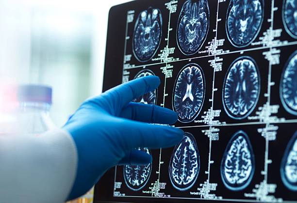 神經(jīng)干細胞移植十大常見(jiàn)問(wèn)題解答:從原理到術(shù)后護理全知道 神經(jīng)干細胞移植十大常見(jiàn)問(wèn)題解答:從原理到術(shù)后護理全知道