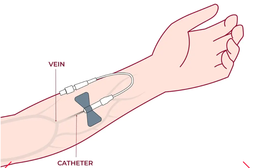 細胞通過(guò)靜脈輸注進(jìn)行給藥，在某些情況下，可以使用其他輸送方法（例如鼻噴霧劑或局部應用）來(lái)針對特定系統。