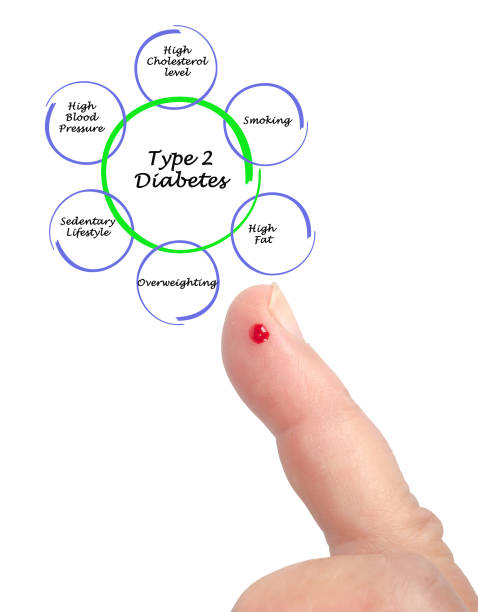 哪些人適合干細胞治療2型糖尿??？專(zhuān)家公布5大評估標準