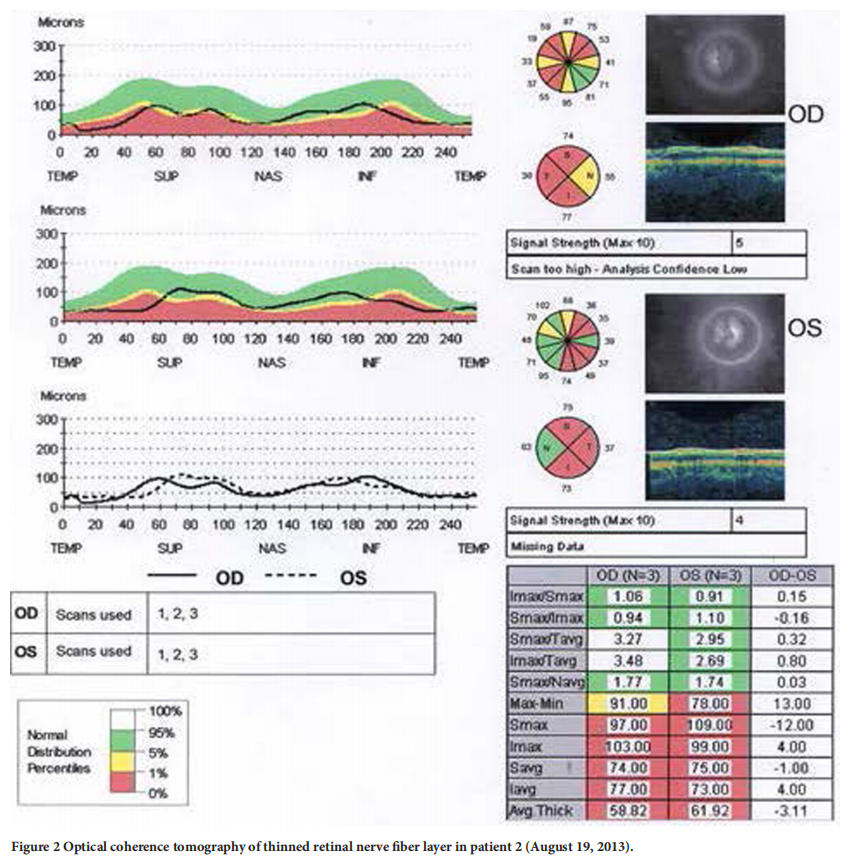 遺傳性視神經(jīng)病變臨床試驗