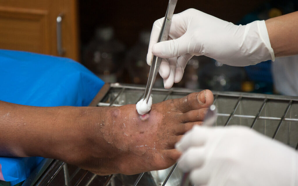 干細胞治療 干細胞治療