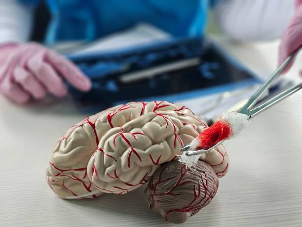 “開(kāi)關(guān)現象”能解決？干細胞為帕金森病治療帶來(lái)新希望