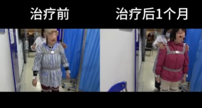 沈女士康復過(guò)程