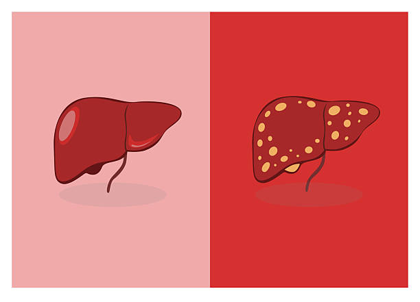 國內外干細胞治療肝硬化進(jìn)展對比：哪項技術(shù)更成熟、效果更好？