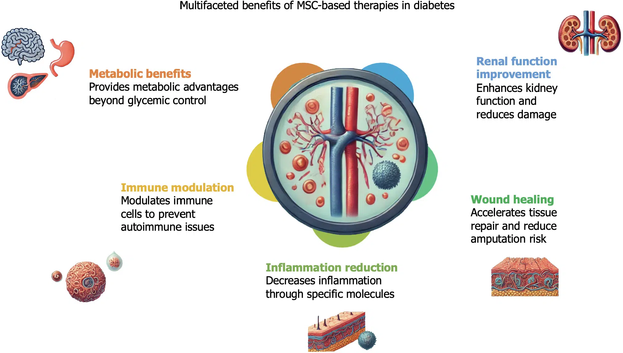 基于間充質(zhì)干細胞的療法對糖尿病患者的各種非血糖效應