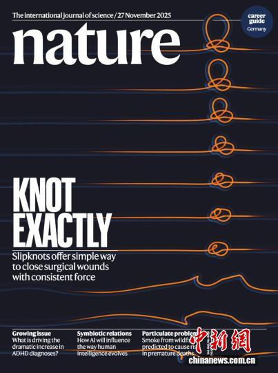 研究成果發(fā)表于國際頂級期刊《自然》并登上雜志封面。研究團隊供圖