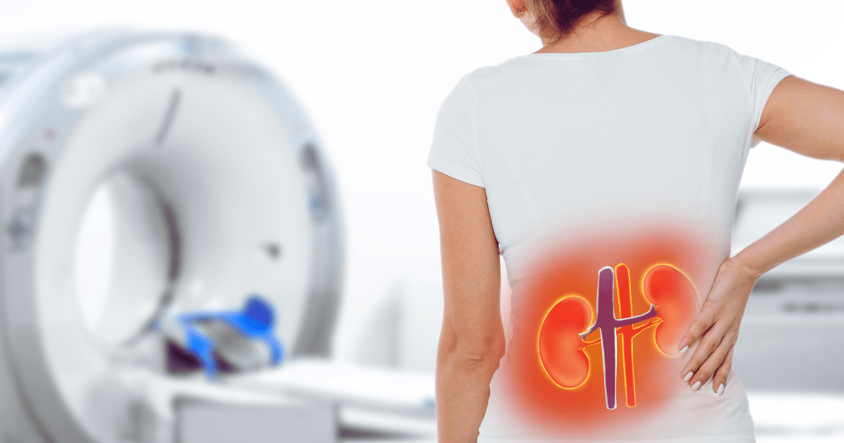 2025年1-12月：干細胞治療狼瘡性腎炎最新臨床進(jìn)展匯總