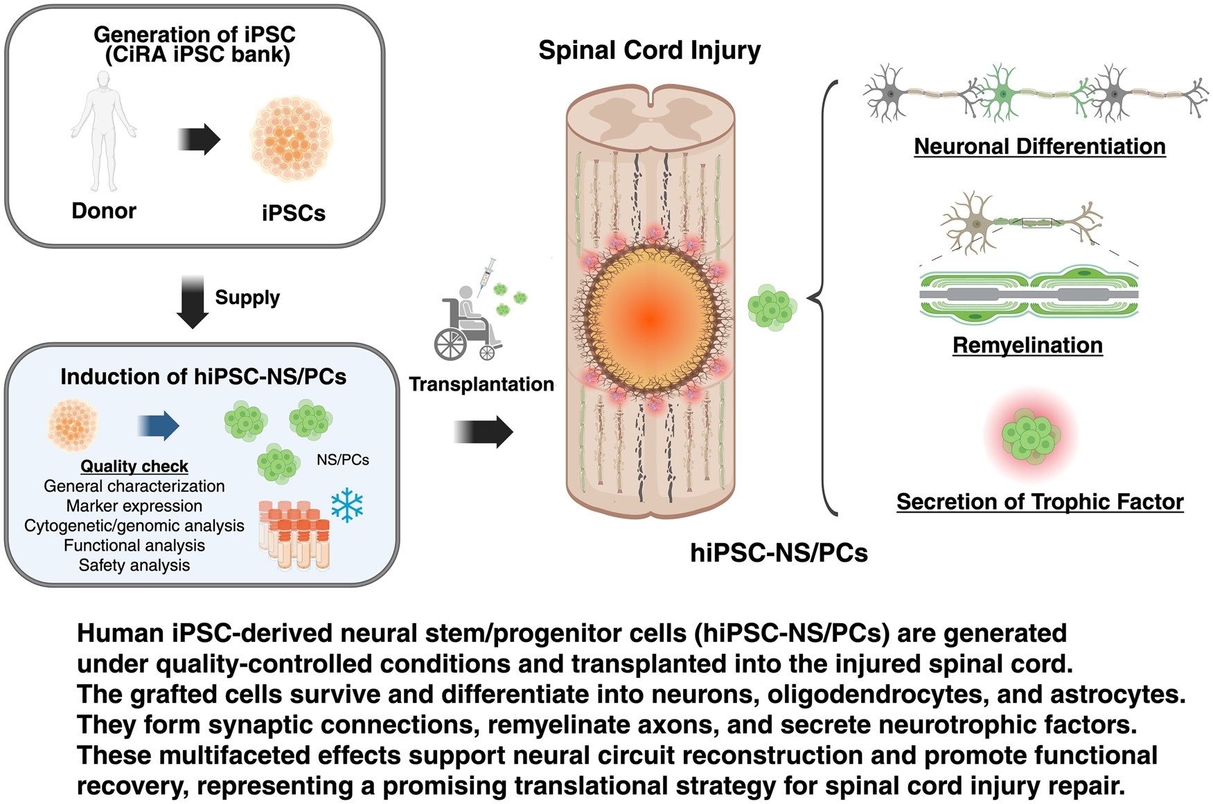 最新綜述！多能干細胞來(lái)源的神經(jīng)干/祖細胞療法治療脊髓損傷：臨床進(jìn)展和轉化展望