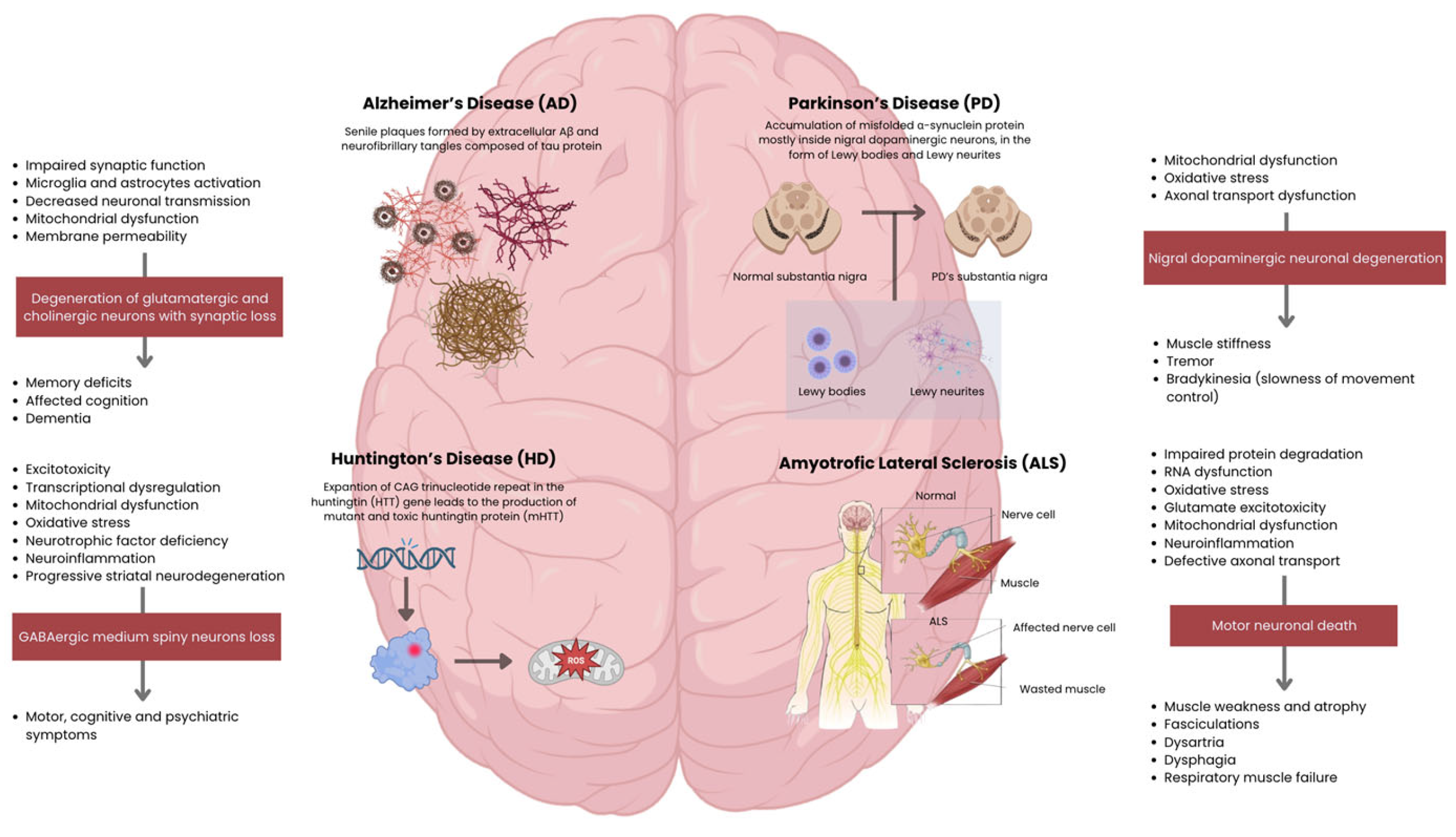 圖2：主要神經(jīng)退行性疾病的病理生理機制和臨床特征。側邊欄概述了從細胞功能障礙到特定神經(jīng)元丟失以及隨后的臨床表現的進(jìn)展過(guò)程。
