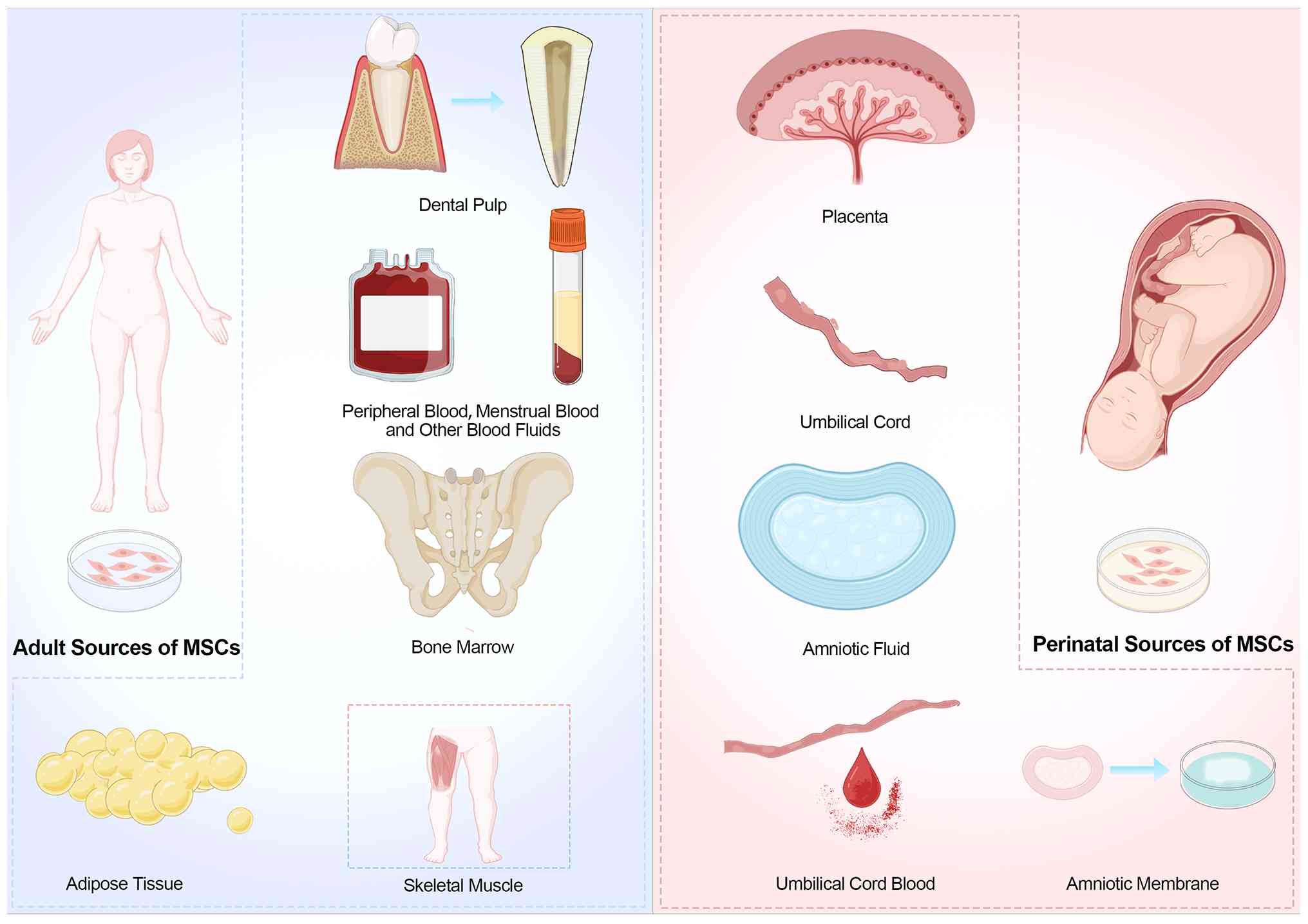 圖2：間充質(zhì)干細胞的來(lái)源。成人間充質(zhì)干細胞可來(lái)源于骨髓、脂肪組織、外周血、骨骼肌和牙髓。圍產(chǎn)期間充質(zhì)干細胞通常取自胎盤(pán)、臍帶、臍帶血、羊水和羊膜。