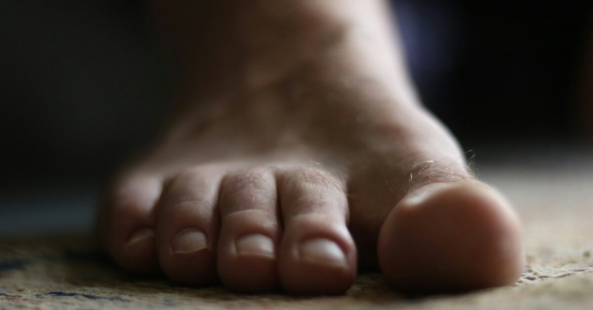 痛風(fēng)治療新格局：URAT1抑制劑競相沖刺，干細胞療法開(kāi)辟全新路徑