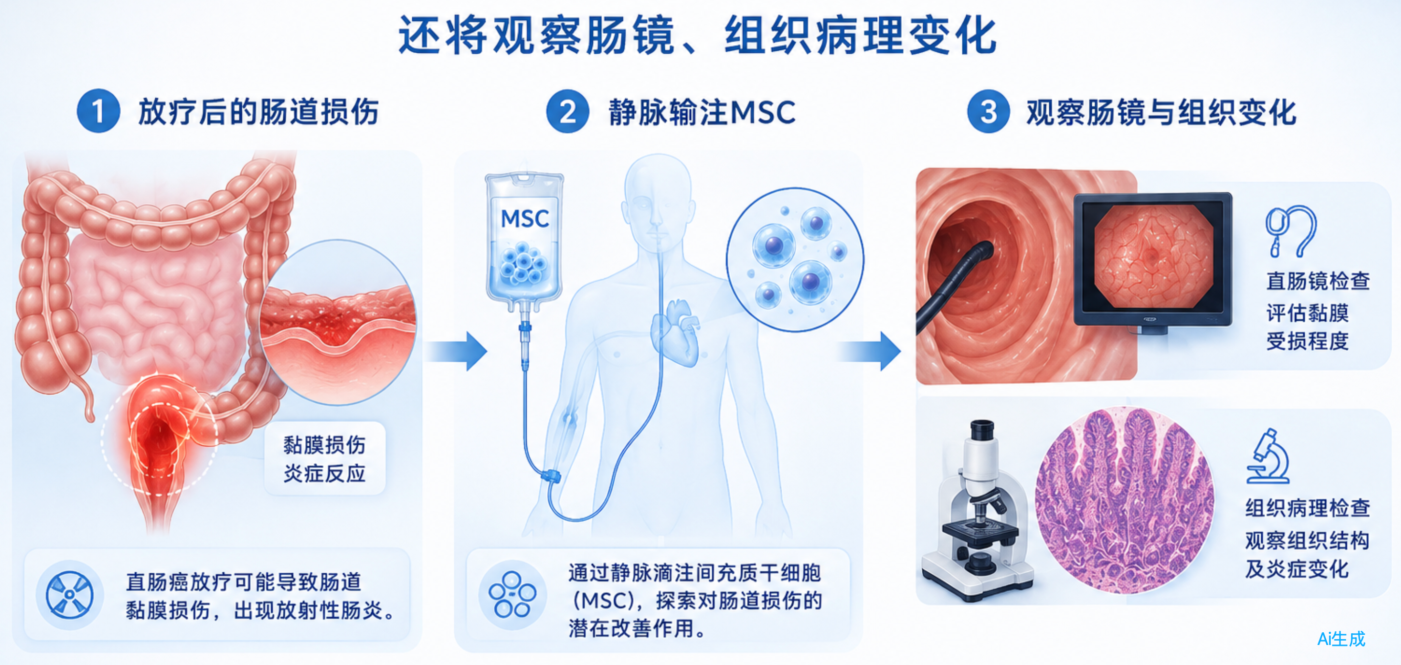 間充質(zhì)干細胞治療放射性直腸炎的過(guò)程